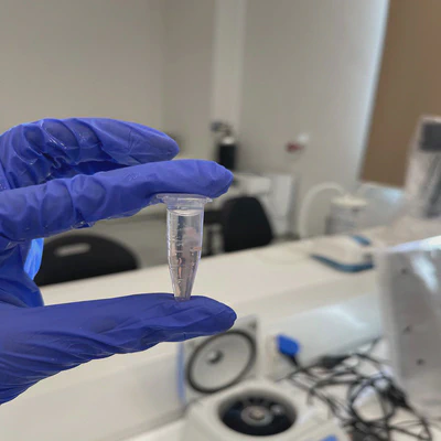 Hands-on DNA extraction from strawberry by my students using lab-prepared reagents.