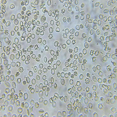 Effect of hypertonic solution on the morphology of RBCs.