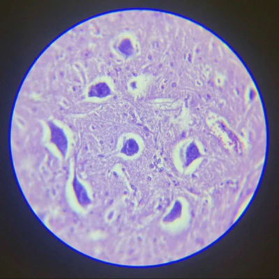 Micrograph illustrating neuronal bodies and neuroglia in lumbar spinal cord.